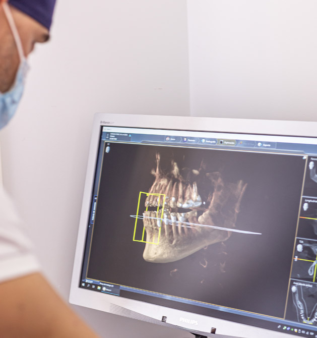 radiografía bucal escaner cbct clinica dental tomas