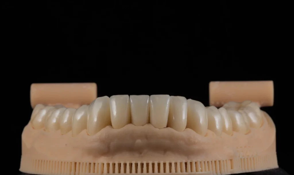 rehabilitacion oral carabanchel