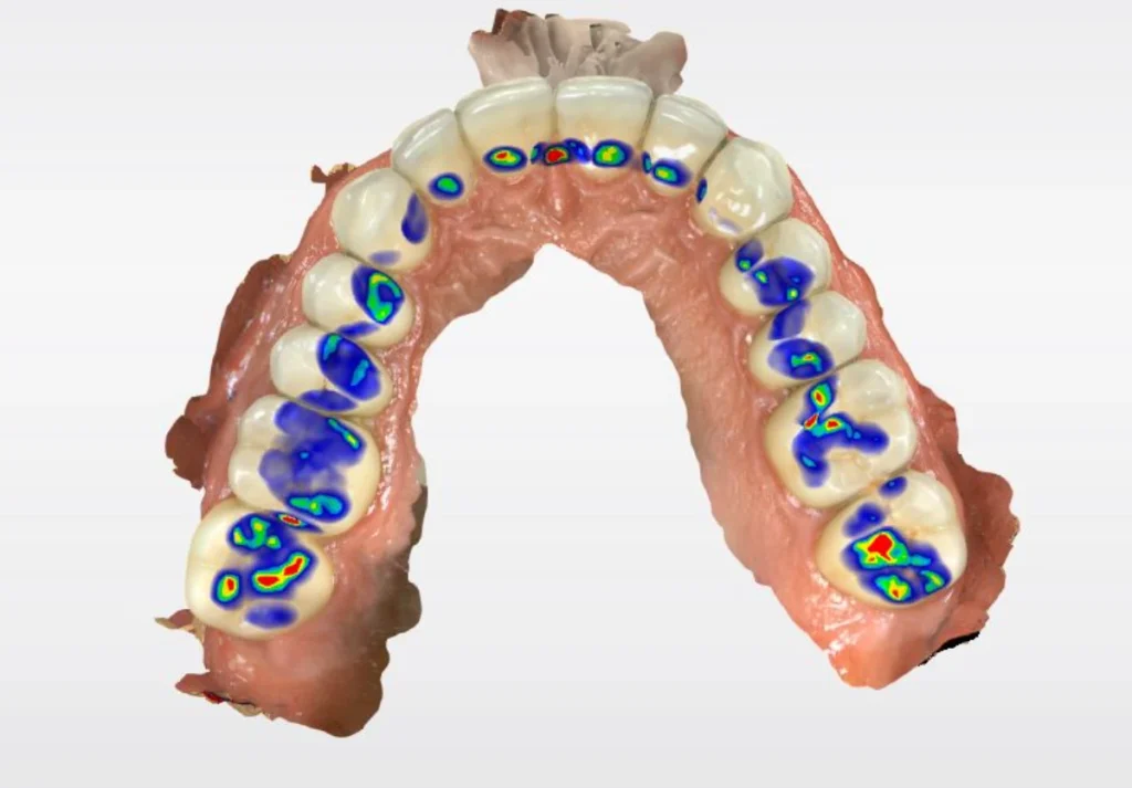 rehabilitacion oral carabanchel