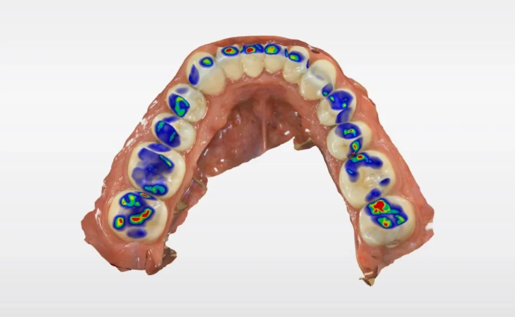 rehabilitacion oral carabanchel