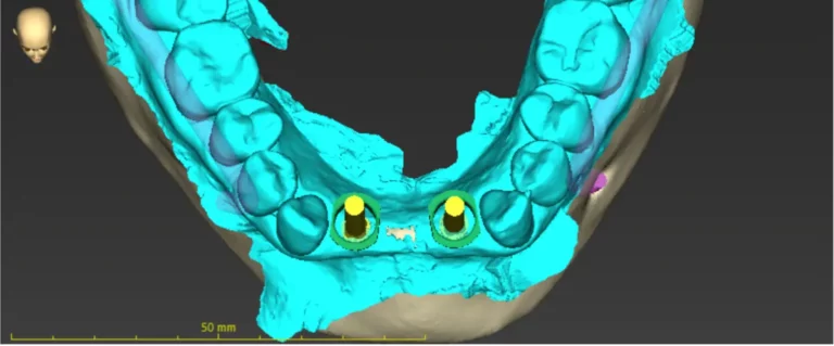 tac-dental-carabanchel (1)